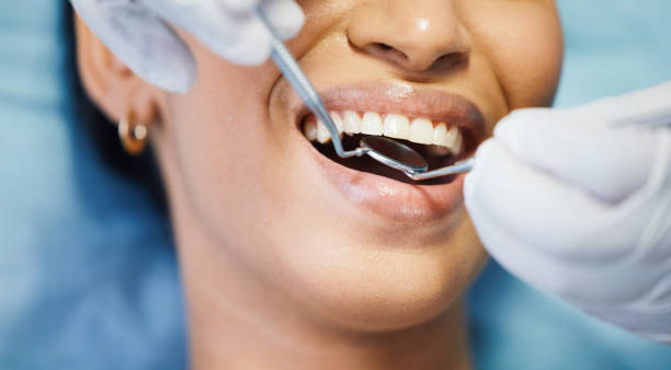 Best Emergency Treatment for Oral Infections in Jasper, GA
