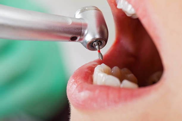 Best Emergency Dental Care for Sports Injuries in Jasper, GA
